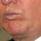 Illustration for article titled A Visual History of Donald Trump's Mouth